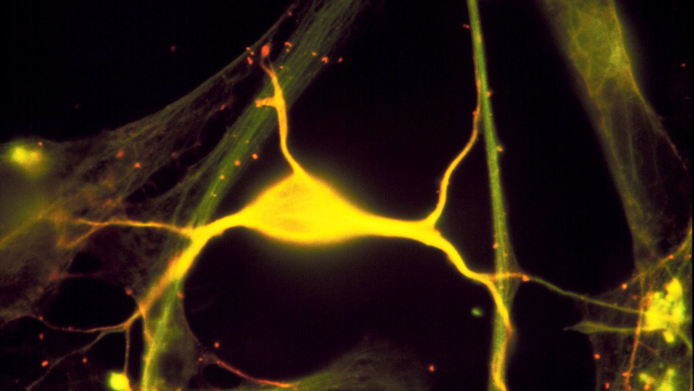 Image 16 neuron tubulin green spectrin red