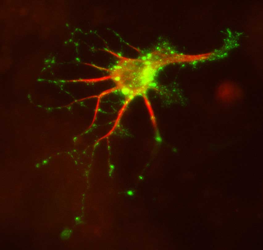 Image 18 Neuron transfected with doublecortin (DCX) DsRed and mannose phosphate receptor (MPR) GFP