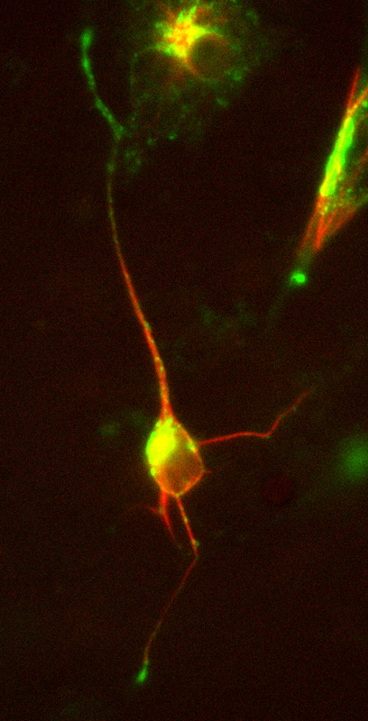Image 19 Neuron transfected with doublecortin (DCX) DsRed and mannose phosphate receptor (MPR) GFP.