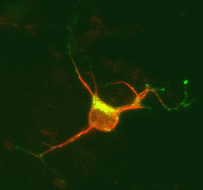 Image 17 neuron dcx dsred mpr gfp