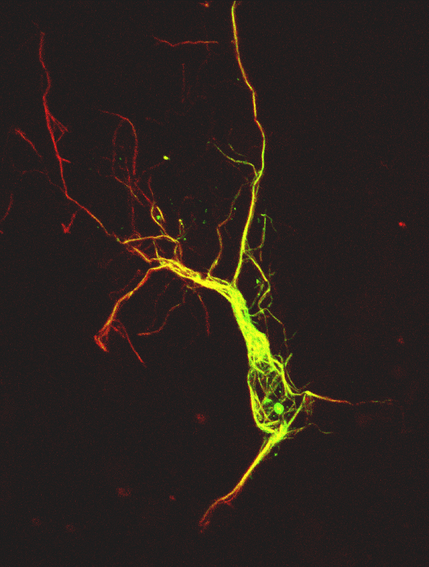 Image 23 confocal neuron