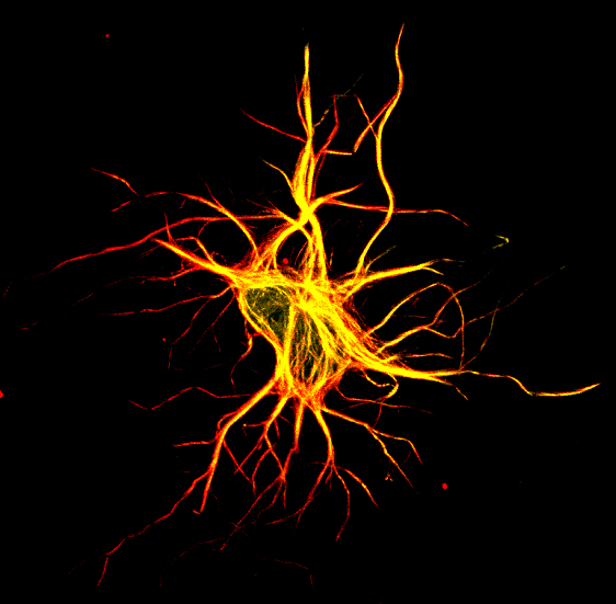 Image 21 neurons confocal dcx mu1a